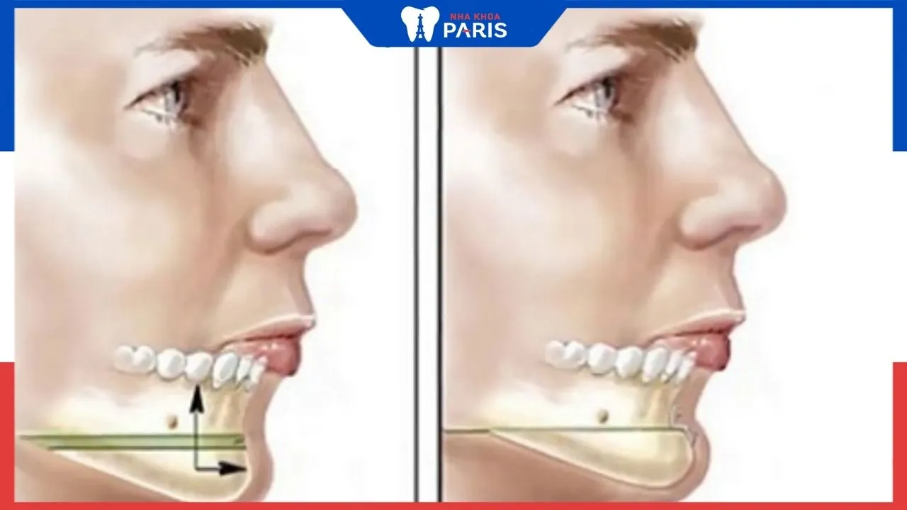 Chi phí tham khảo và tiêu chí chọn cơ sở thực hiện an toàn