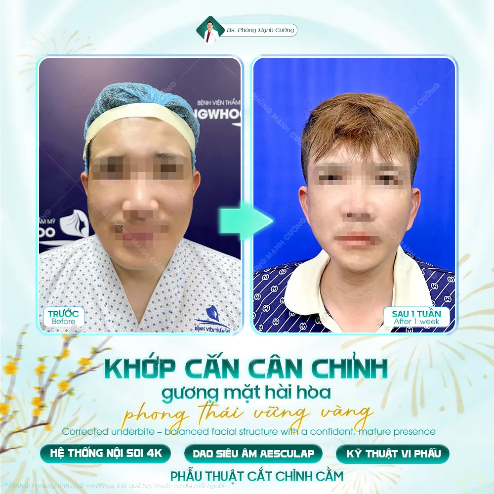 So sánh nhanh — ưu nhược điểm