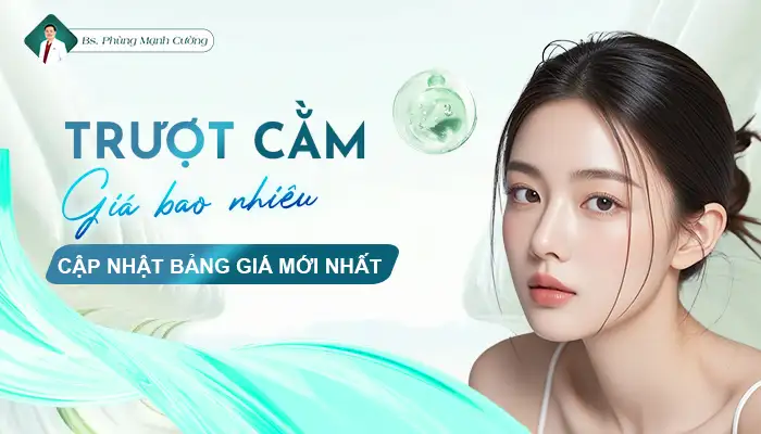 Chi phí phát sinh — những khoản dễ bị bỏ qua