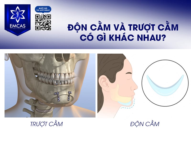 Nguy cơ và biến chứng thường gặp — Làm sao để giảm rủi ro?