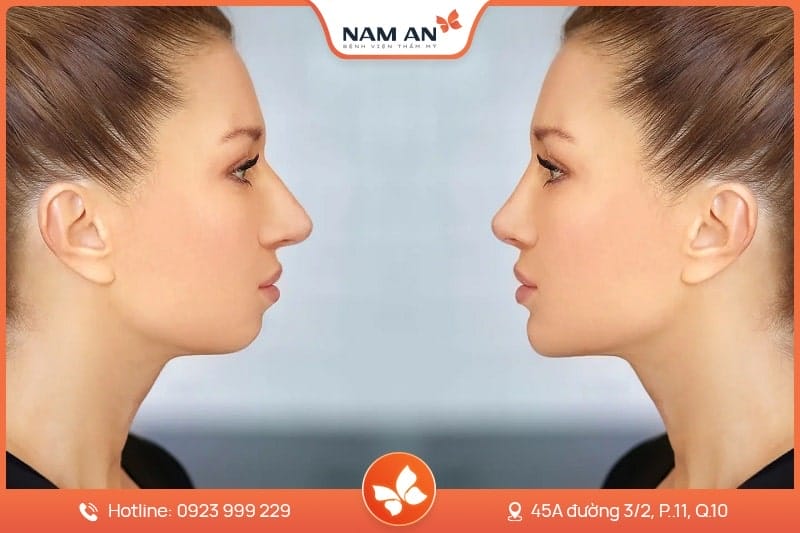 Trượt cằm có bằng chứng lâm sàng hỗ trợ không?