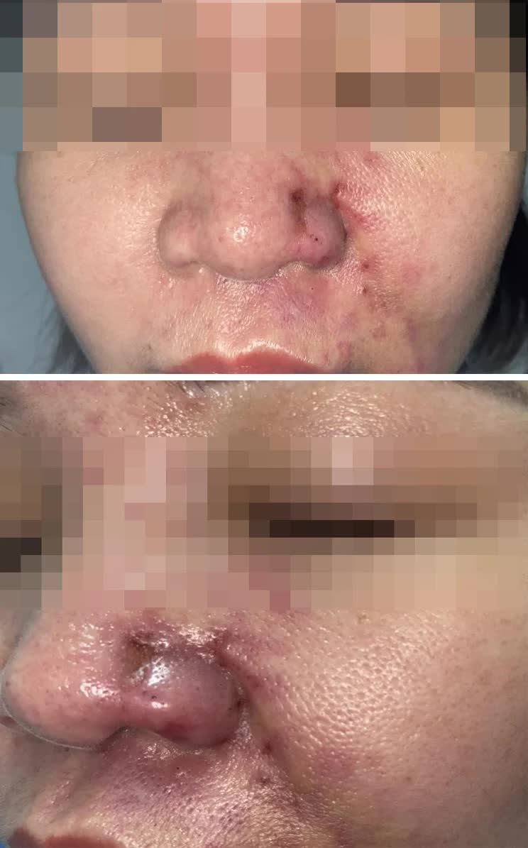 Những hiểu lầm phổ biến và câu trả lời từ thực tế lâm sàng