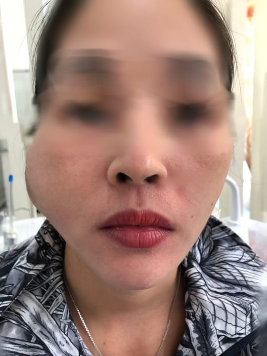 Khi nào cần hỏi ý kiến chuyên khoa ngay lập tức?
