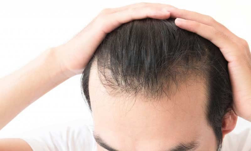Bao nhiêu là đủ — kỳ vọng về mật độ tóc và cách đánh giá tiến trình?