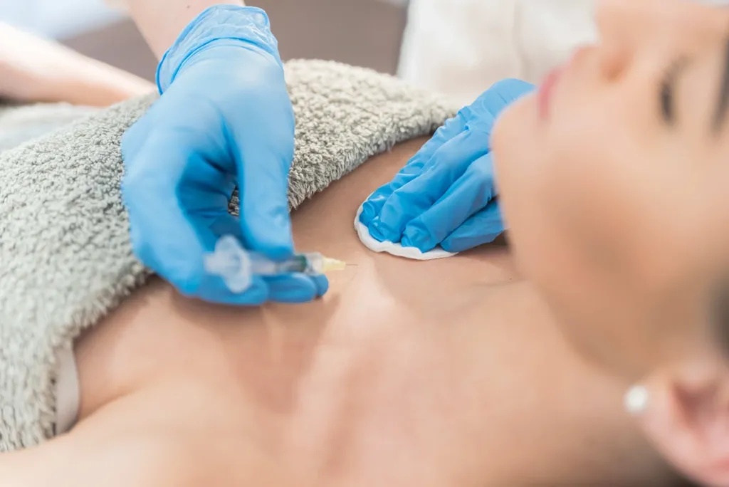 Những biến chứng filler ngực: rủi ro sức khỏe nào đáng lo?