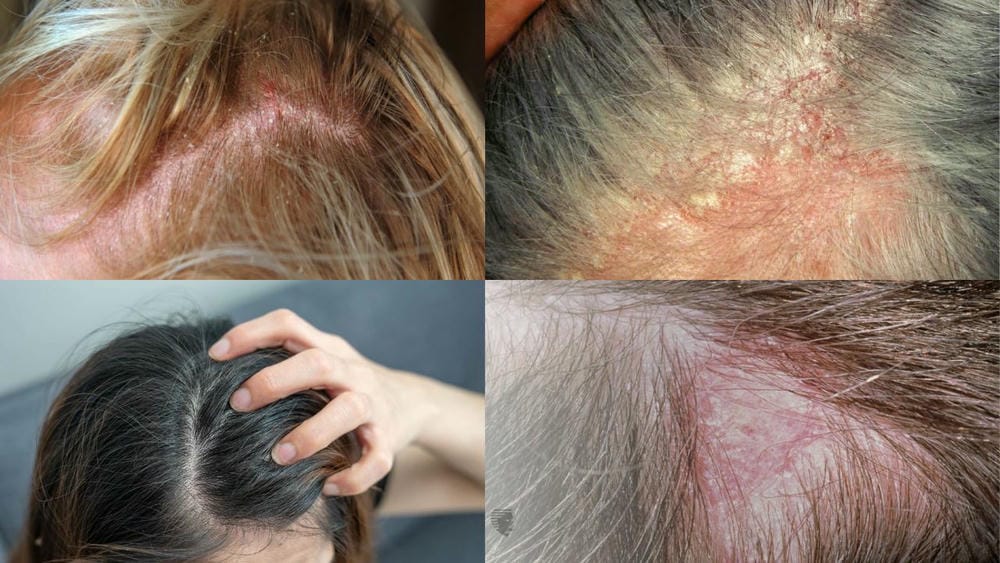 Điều trị an toàn cho nam tuổi dậy thì — những lựa chọn và lưu ý