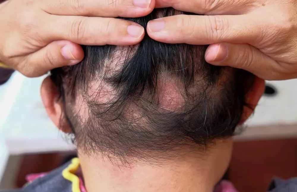 Bằng chứng lâm sàng và điều gì chứng minh được hiệu quả?