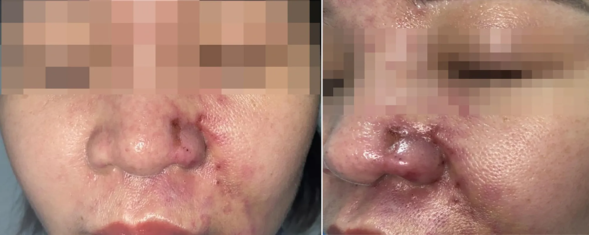 Phương pháp điều trị hiện có có hiệu quả đến mức nào — có bằng chứng gì gần đây?