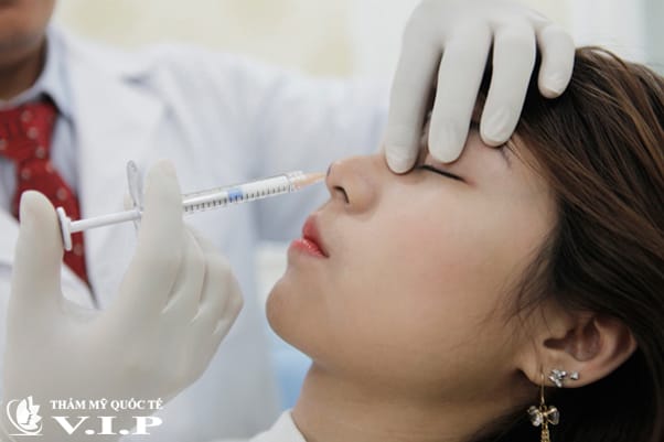 Checklist chuẩn bị trước khi làm filler nếu có tiền sử viêm xoang