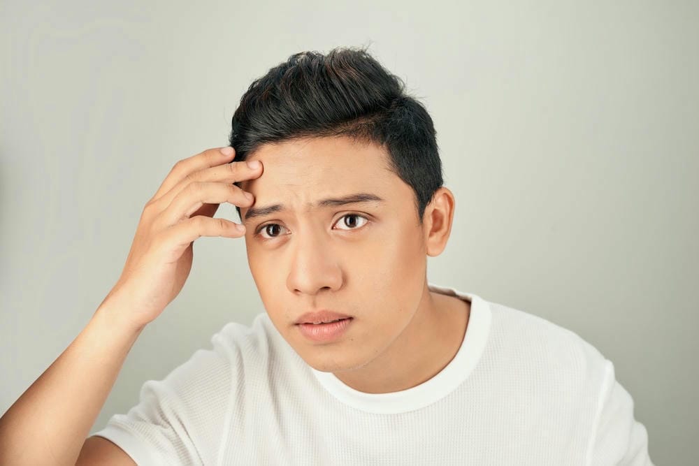 Tại sao vết lõm giữa trán không hết dù đã chăm sóc da kỹ lưỡng tại nhà?