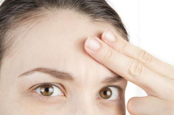 Vết lõm giữa trán có đường dọc là do sẹo lõm trán hay do nếp nhăn động — làm sao phân biệt?