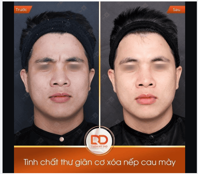 Thời gian hồi phục và mong đợi kết quả