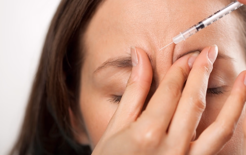 Xóa nhăn cau mày bằng tiêm botox có an toàn và hiệu quả như thế nào?