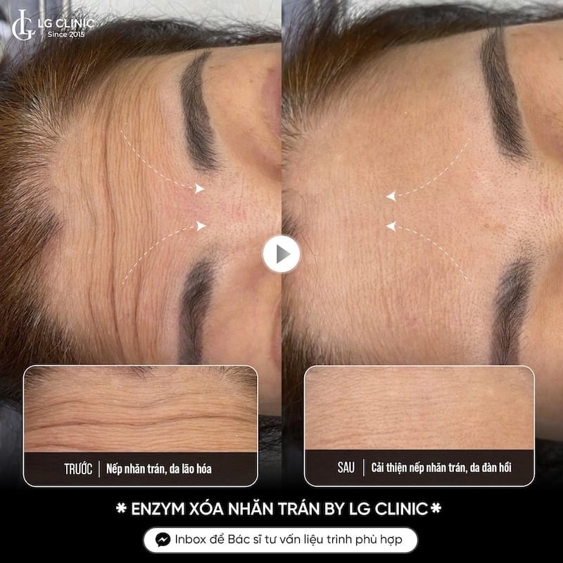Bước tiếp theo nếu đang cân nhắc điều trị tại Lona Skin Lab