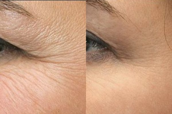 Kết hợp điều trị có hiệu quả hơn không?