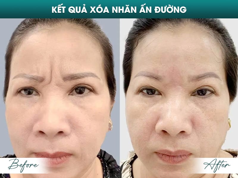 Một số câu hỏi khách hàng thường đặt — trả lời ngắn gọn