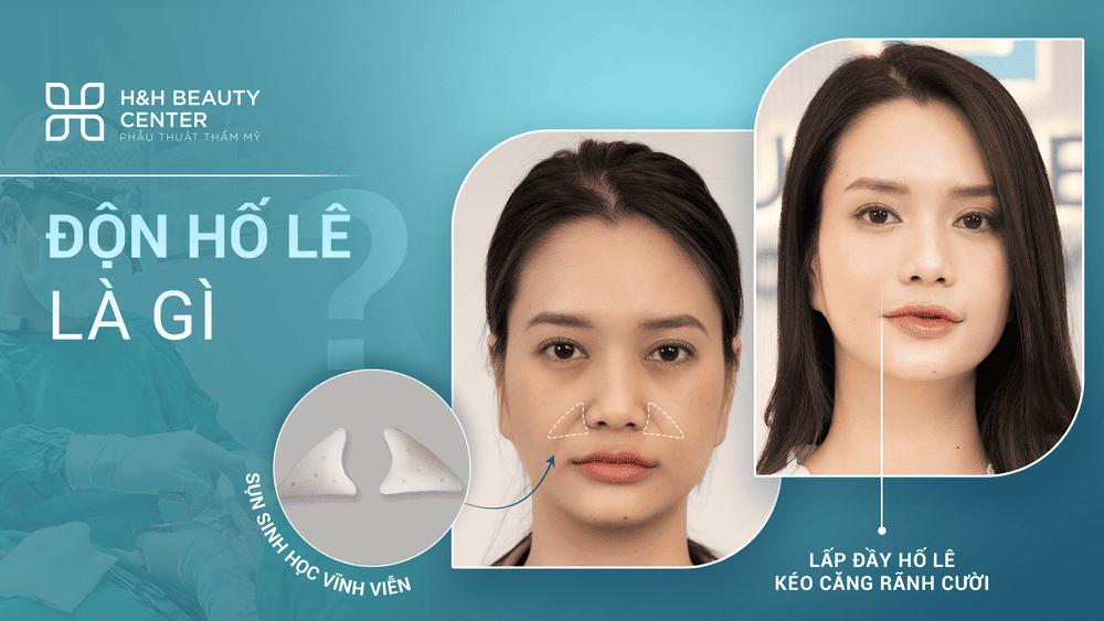 Những bằng chứng lâm sàng nào hỗ trợ lựa chọn giữa các phương pháp?
