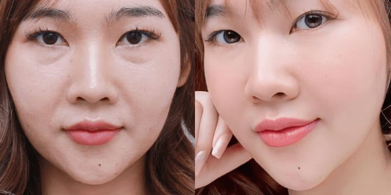 Điều gì nói lên tính lâu dài trong nghiên cứu?
