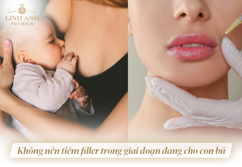Nếu muốn làm đẹp khi đang cho con bú, có lựa chọn an toàn hơn không?