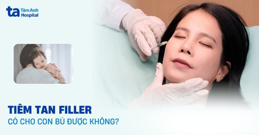 So sánh: Tiêm filler, chỉ nâng cơ không phẫu thuật và chờ đến khi ngừng cho con bú