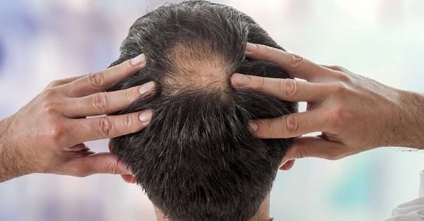 Làm sao để chọn cơ sở khám chữa rụng tóc — những tiêu chí quan trọng?