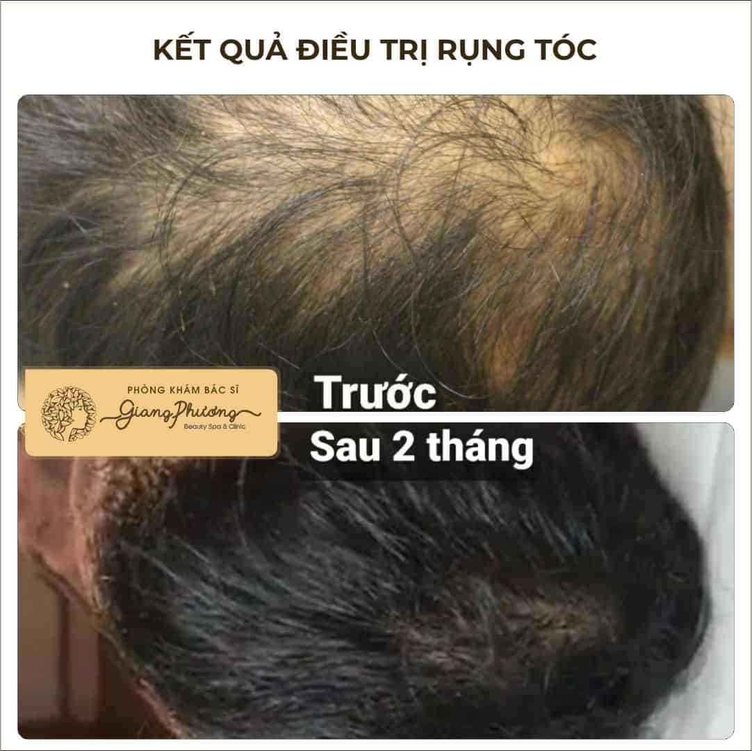 Quy trình khám và liệu trình tiêu chuẩn tại cơ sở y tế uy tín nên như thế nào?