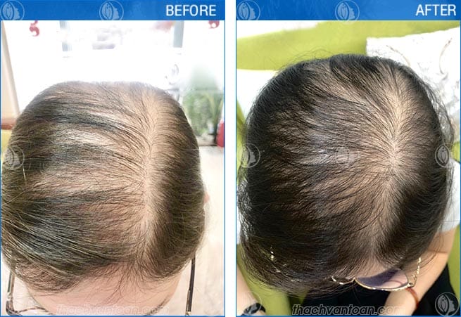 Những liệu pháp hỗ trợ tại nhà và bổ sung — nên dùng hay không?
