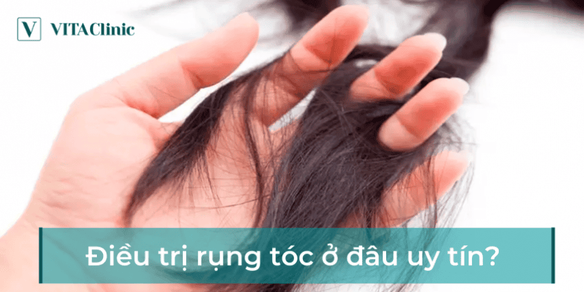 Tại sao tóc rụng nhiều — vấn đề của bạn là rụng tạm thời hay rụng mạn tính?