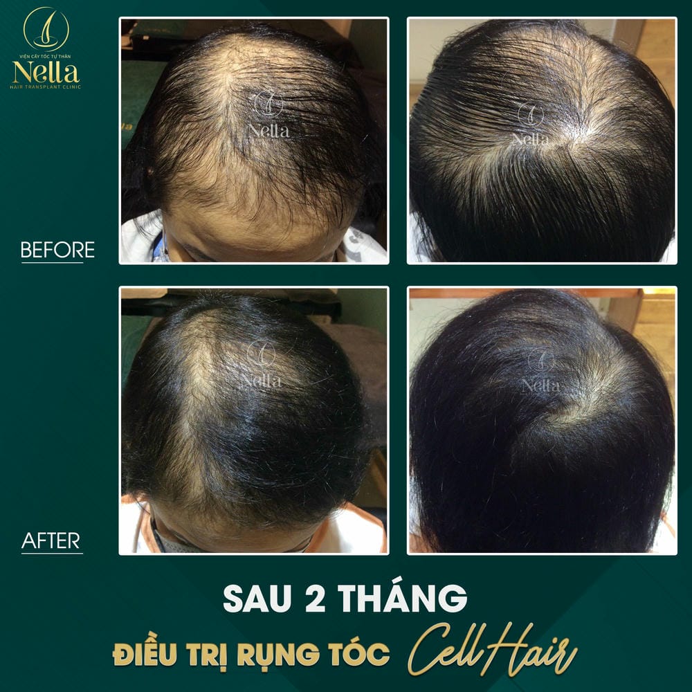 An toàn, rủi ro và làm sao để chọn nơi điều trị uy tín?