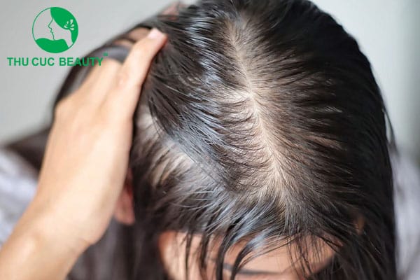 Khoảng thời gian nhìn thấy kết quả