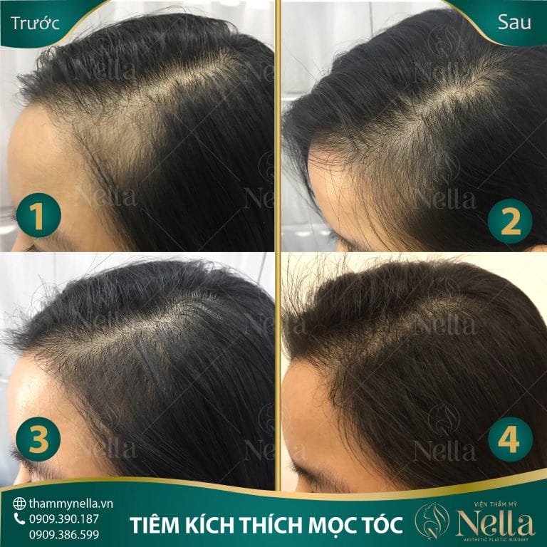 Chi phí và thời gian điều trị: nên chuẩn bị gì?