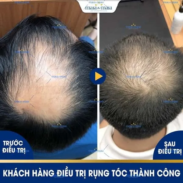 Bằng chứng y học hiện tại nói gì về các lựa chọn phổ biến?