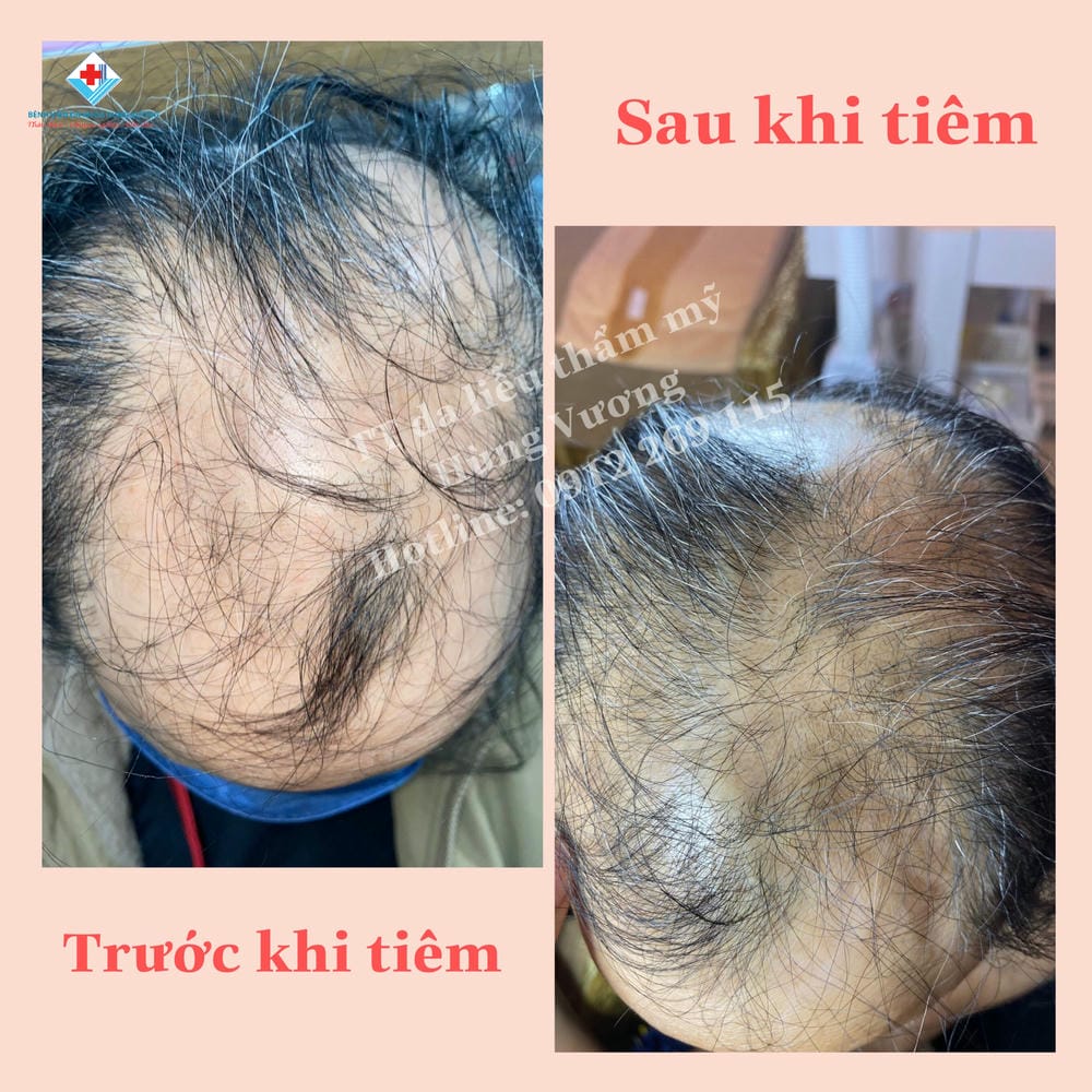 Nên tham khảo địa chỉ nào ở HCM, Hà Nội và Cần Thơ?