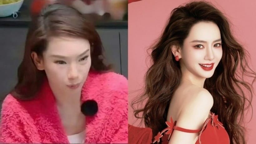 Phải làm gì ngay khi phát hiện đơ mặt sau tiêm?
