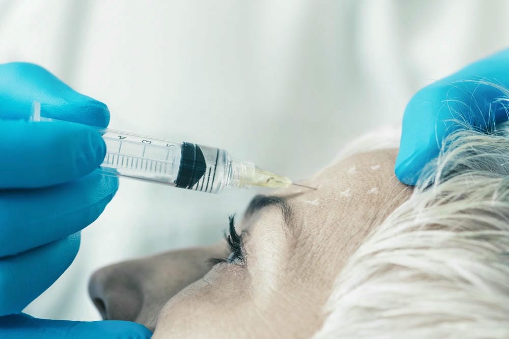 Thuốc nhỏ mắt (Apraclonidine, Oxymetazoline) — hiệu quả tạm thời cho ptosis