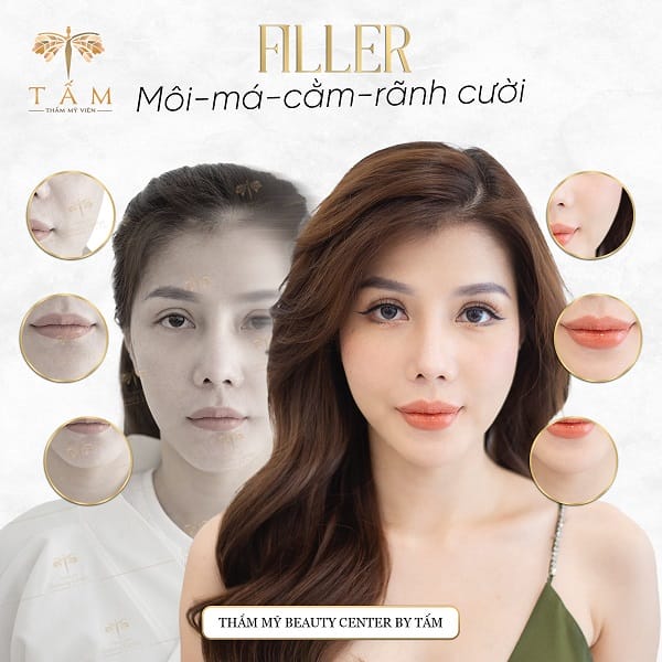 Muốn đặt lịch tư vấn — làm thế nào để so sánh và quyết định nhanh?