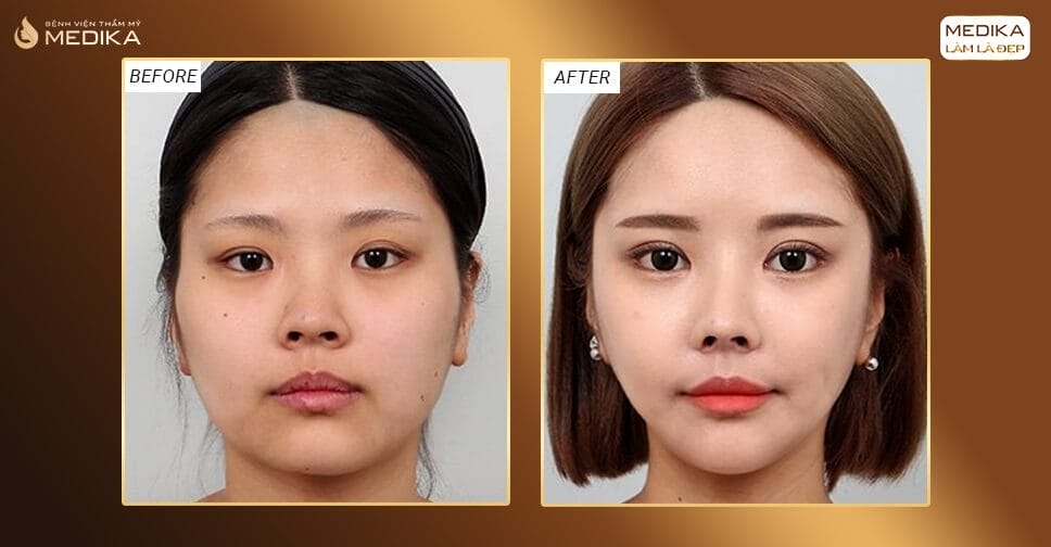 Làm sao để chọn nơi thực hiện đẩy rủi ro xuống thấp nhất và có kết quả tự nhiên?