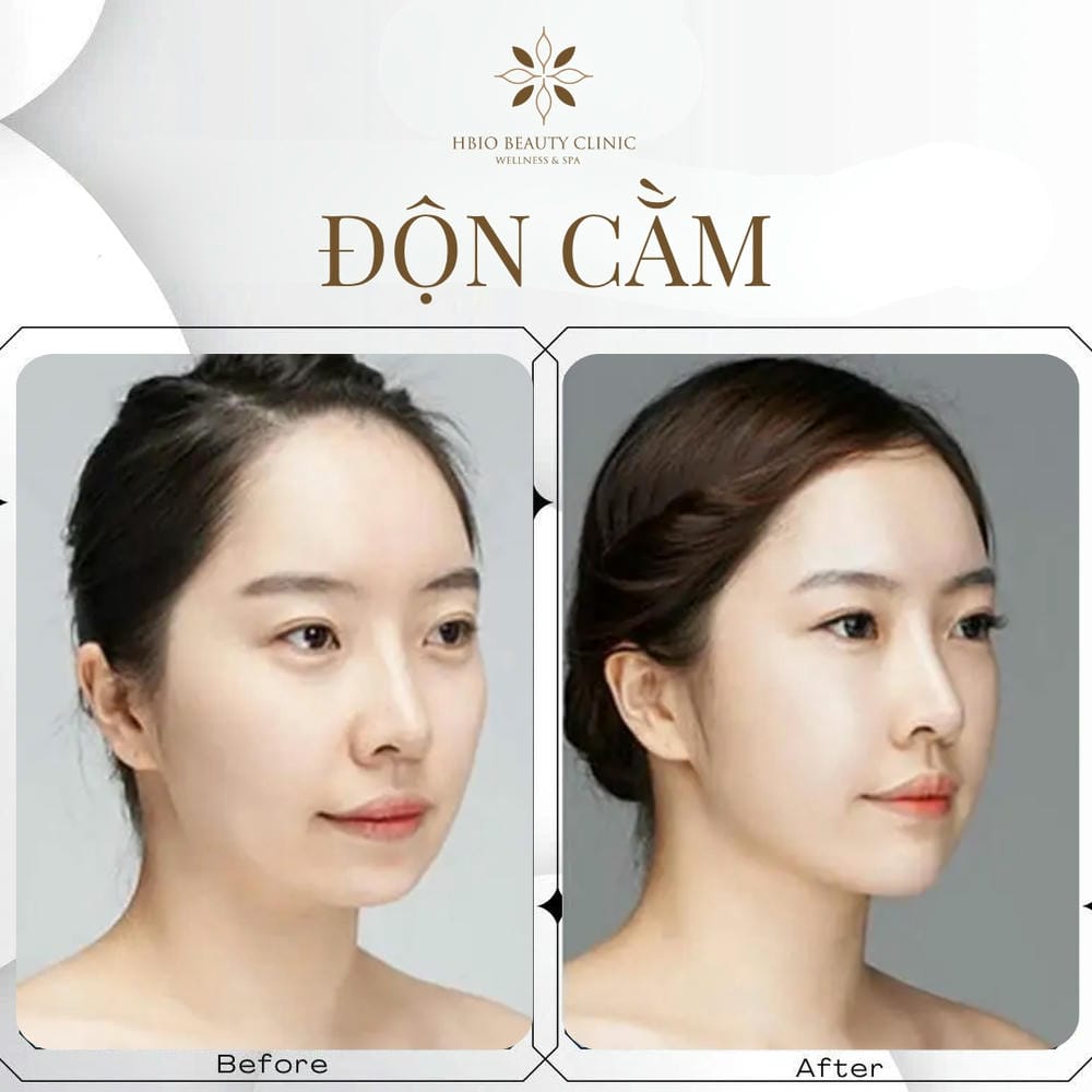 Làm thế nào để chọn nơi và bác sĩ thực hiện an toàn?