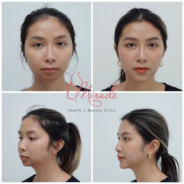 Cơ chế tác động của từng phương pháp