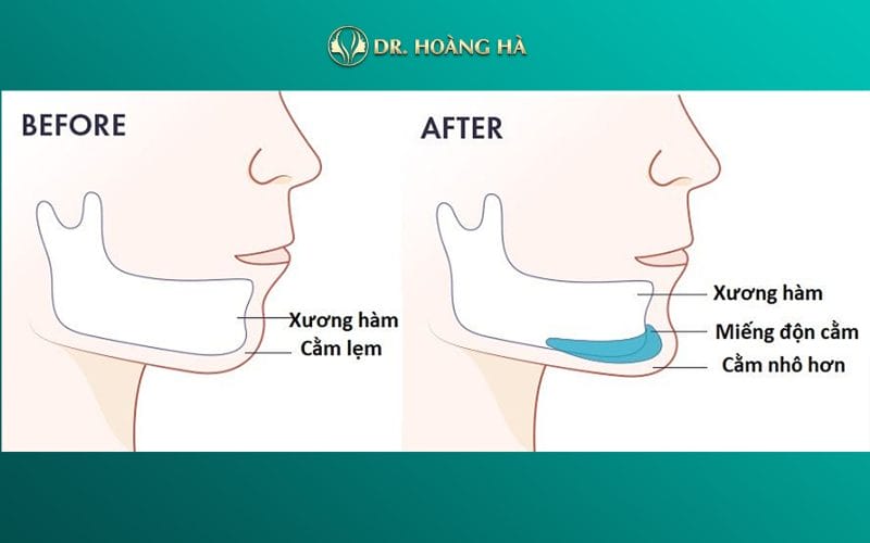 Những câu hỏi người quyết định thường tự hỏi — và câu trả lời ngắn gọn