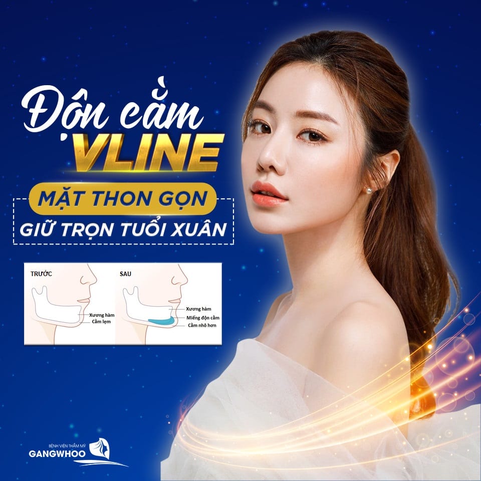 Phẫu thuật độn cằm (implant hoặc genioplasty): Khi nào nên chọn và cần biết gì?