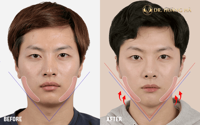 Bằng chứng lâm sàng và điều gì nên đọc trước khi quyết định?