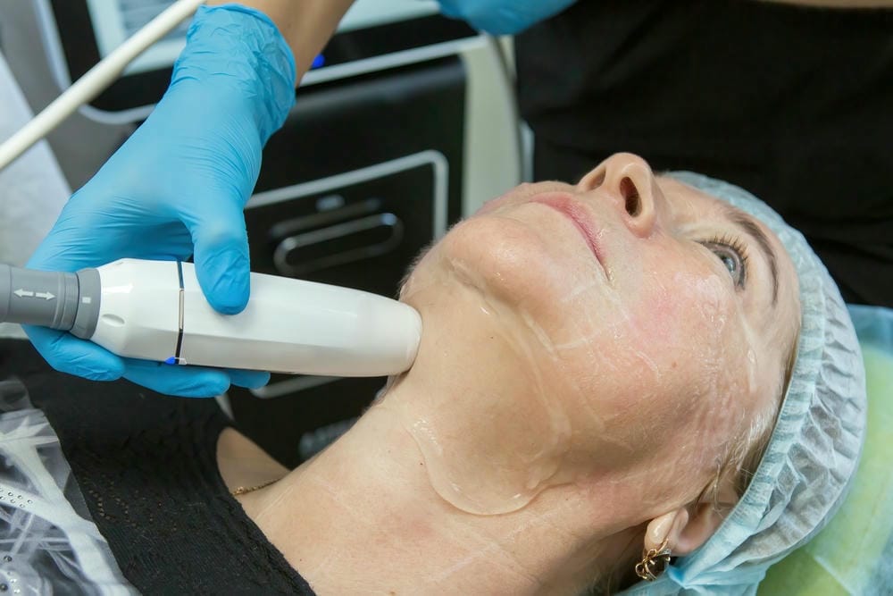 Tiêm Aptos khác gì so với filler, botox, HIFU hay nâng cơ phẫu thuật?