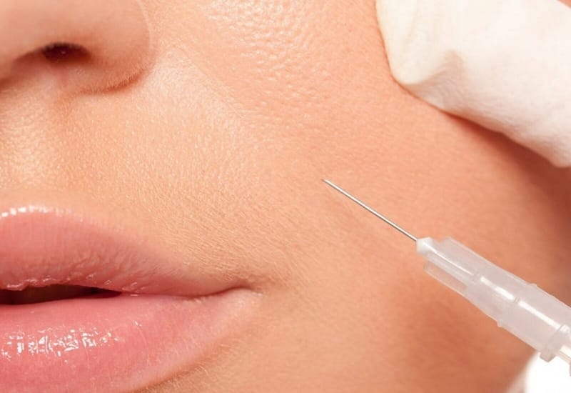 Nếu lo lắng vì phải “hạn chế cười” trong đời sống hằng ngày — có cách nào giảm ảnh hưởng không?