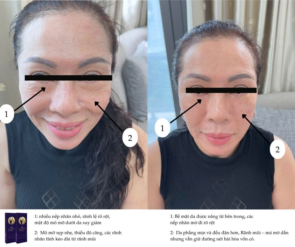 Nên làm gì nếu đã tiêm ở nơi không rõ nguồn gốc hoặc xuất hiện triệu chứng bất thường?