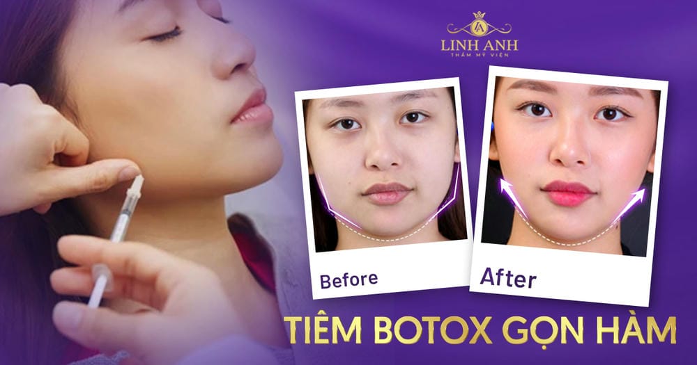 Ở đâu uy tín — gợi ý một số cơ sở tham khảo tại HCM, Hà Nội và Cần Thơ