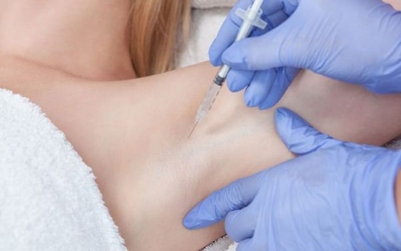 Các phương pháp xâm lấn tối thiểu (cạo, hút, laser, RF, miraDry)