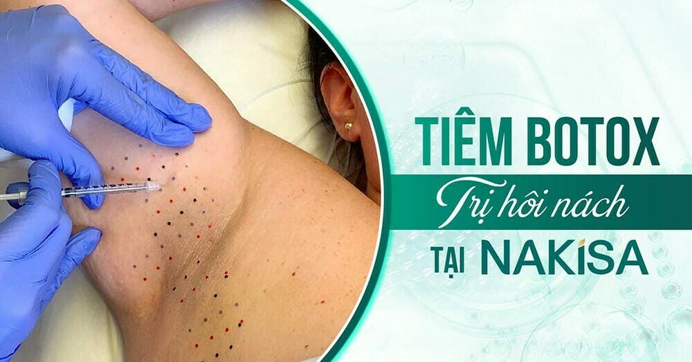 Tiêm botox