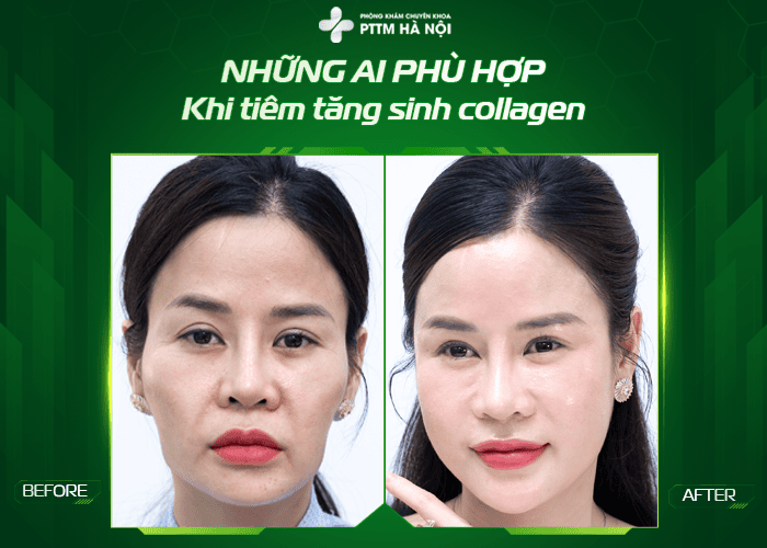 Hiệu quả thực tế: khi nào thấy kết quả và kéo dài bao lâu?