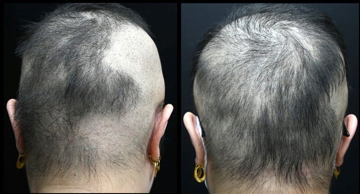 Lưu ý chăm sóc và chống chỉ định